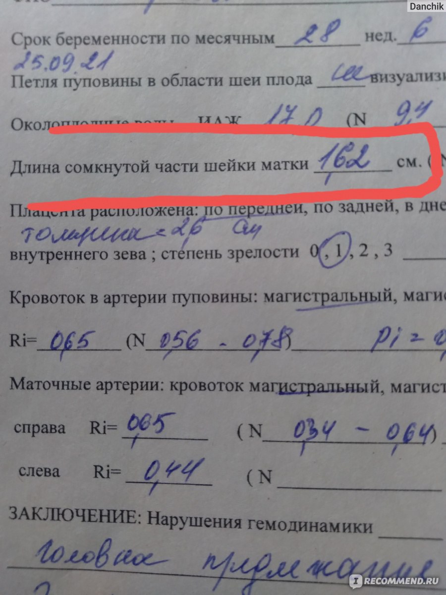 Ограничение доступа