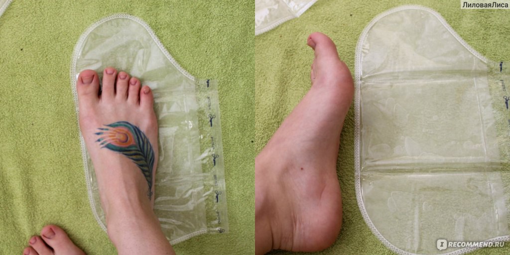 Носки для педикюра до и после