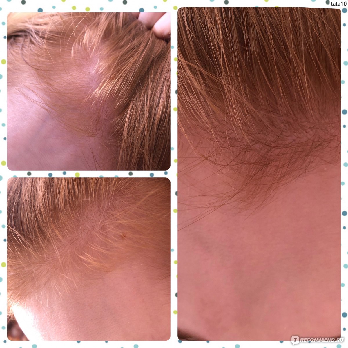Средство от выпадения волос Эсвицин, "ВиоФарм"  фото