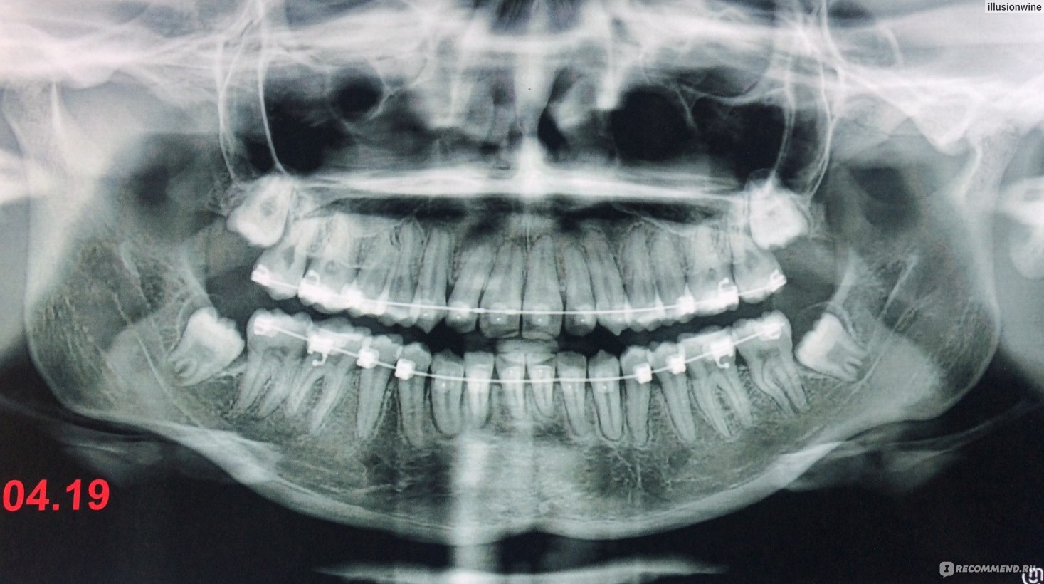 Вид работы: Лечение зубов