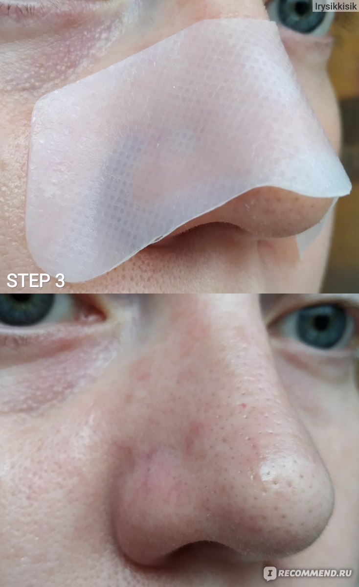 Набор от чёрных точек Elizavecca Milky Piggy Black Head Solution 3 Step Nose Strip фото