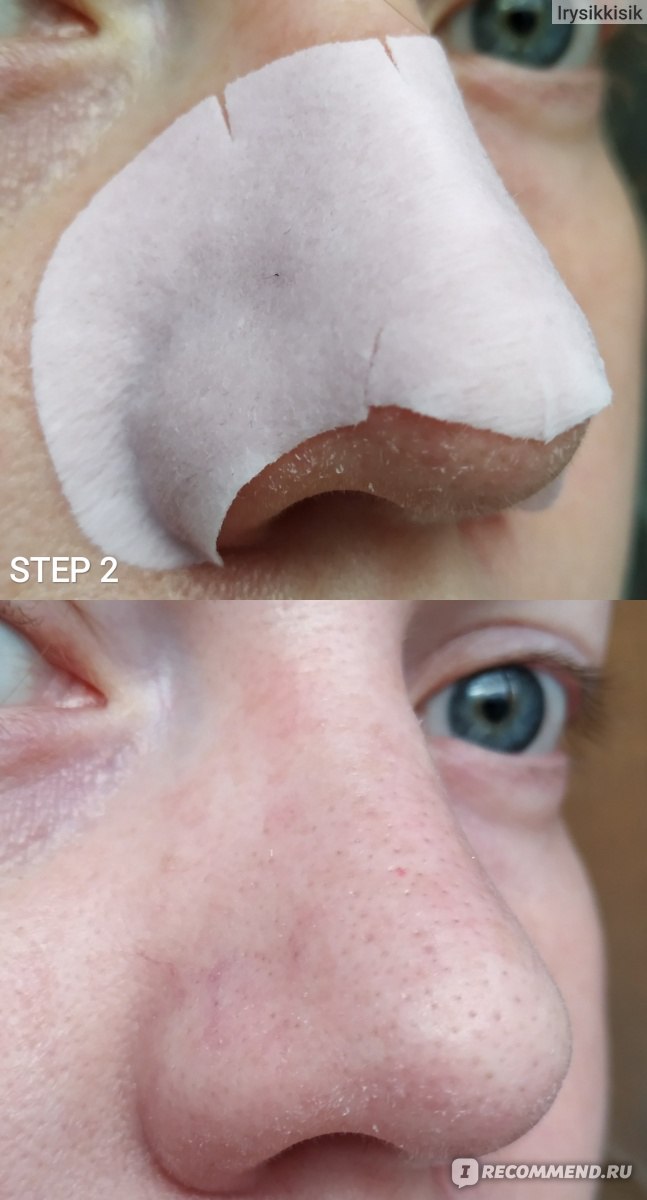 Набор от чёрных точек Elizavecca Milky Piggy Black Head Solution 3 Step Nose Strip фото