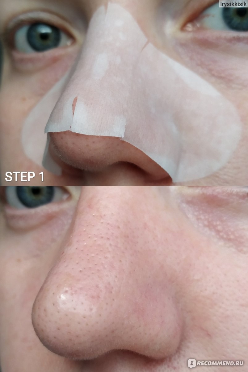 Набор от чёрных точек Elizavecca Milky Piggy Black Head Solution 3 Step Nose Strip фото