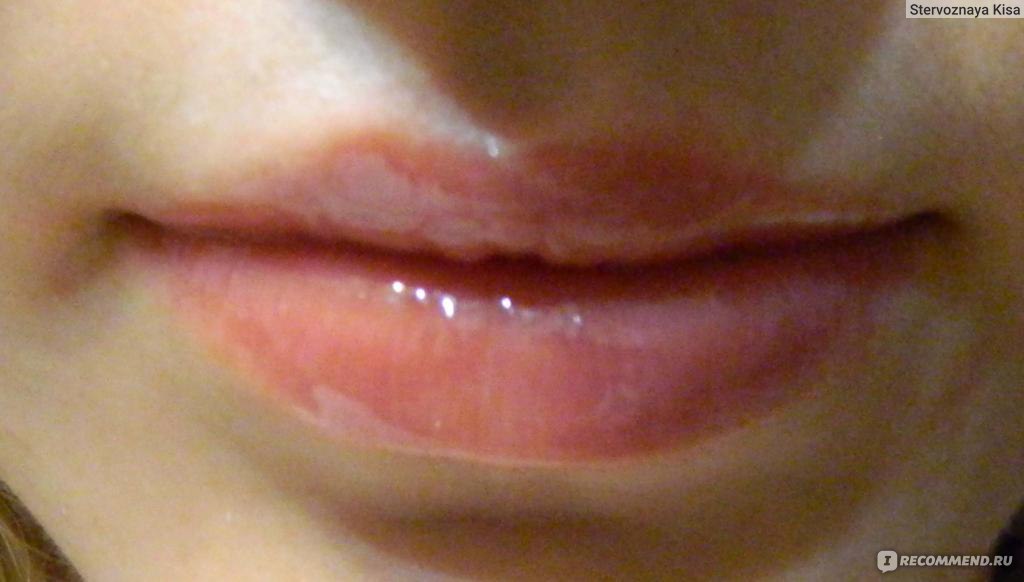 Wet Lips Pics