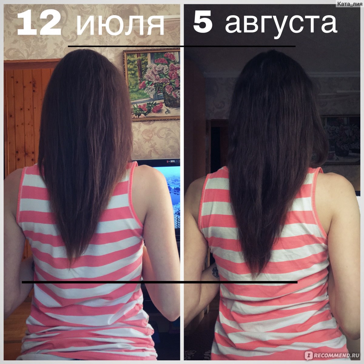 Результаты роста волос. Никотиновая кислота для волос до и после. Никотиновая кислота для роста волос. Никотиновая кислота для волос до и после рост. Никотинка для волос до и после.