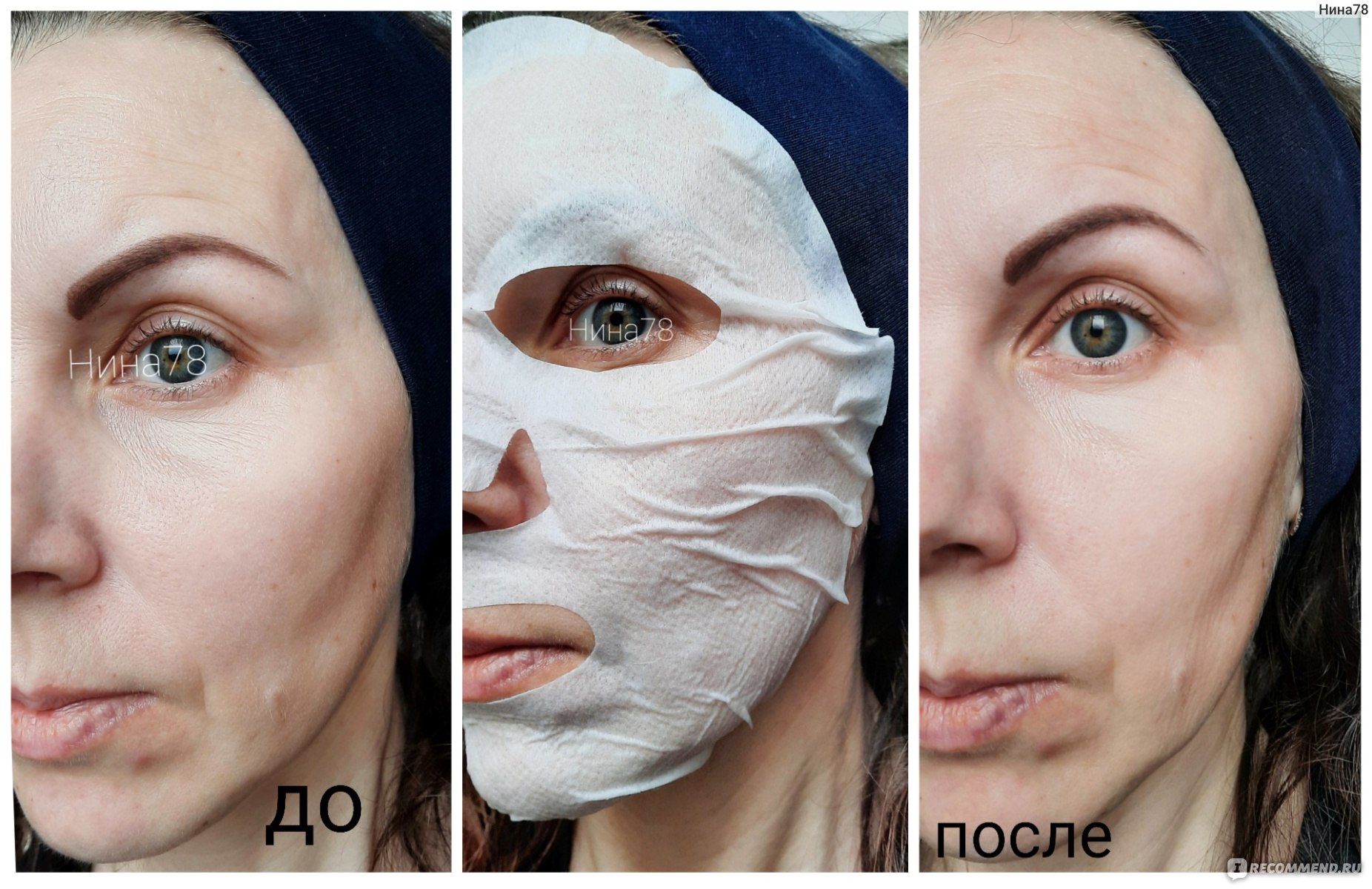 Нужно ли наносить крем после тканевой маски. Маска для лица. Эффект от маски для лица. Тканевая маска эффект. Ткань на лице.