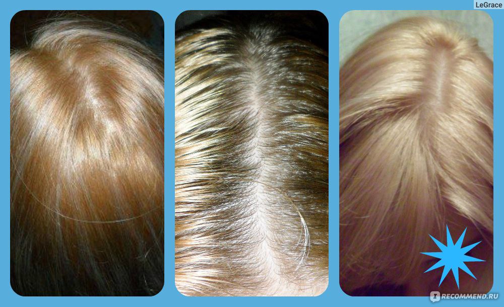 L'oreal краска для волос при обесцвечивание