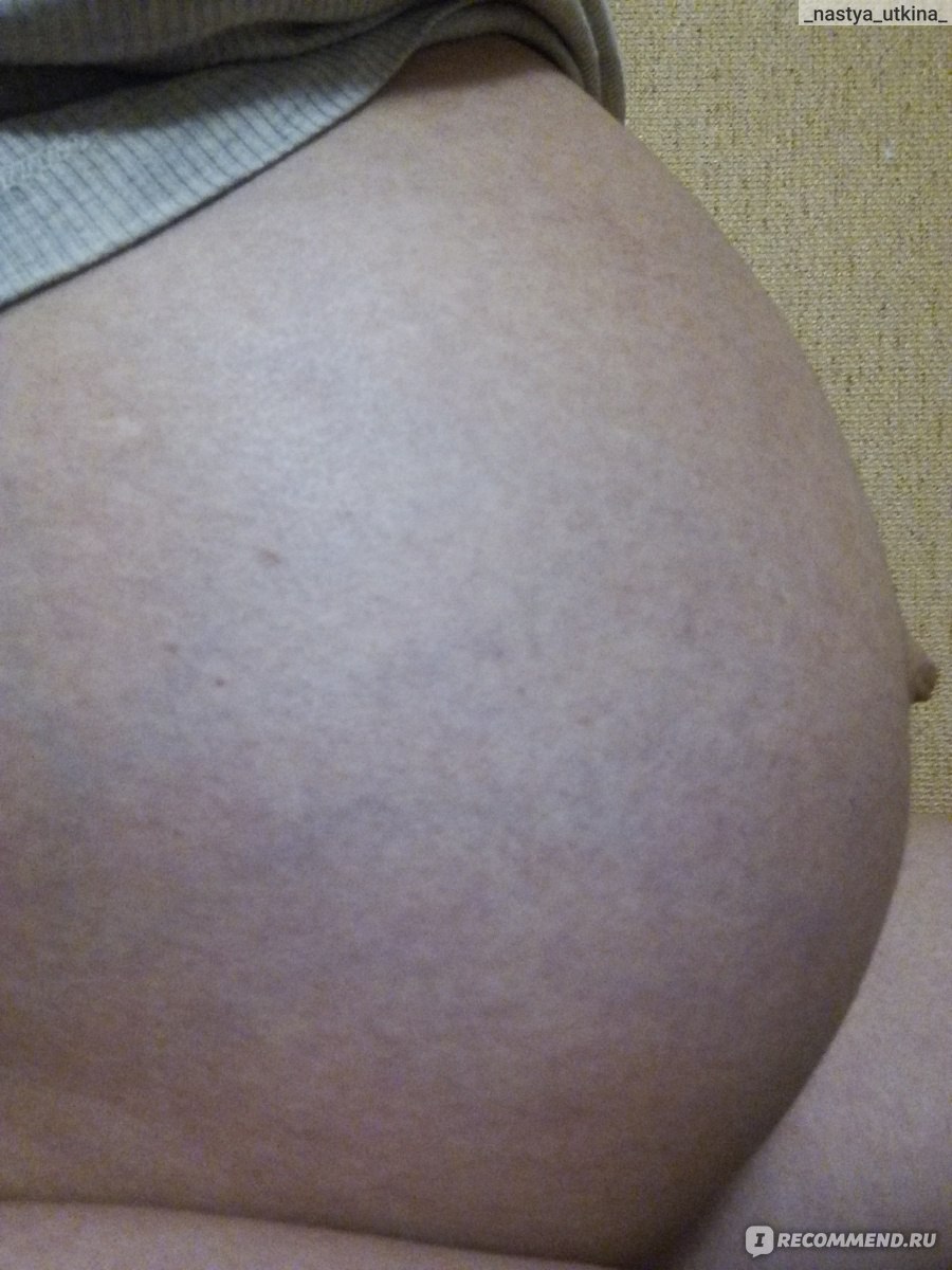 чем мазать живот и грудь от растяжек при беременности фото 48