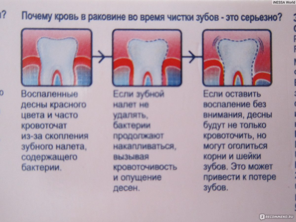 Остановить кровотечение удаления зуба