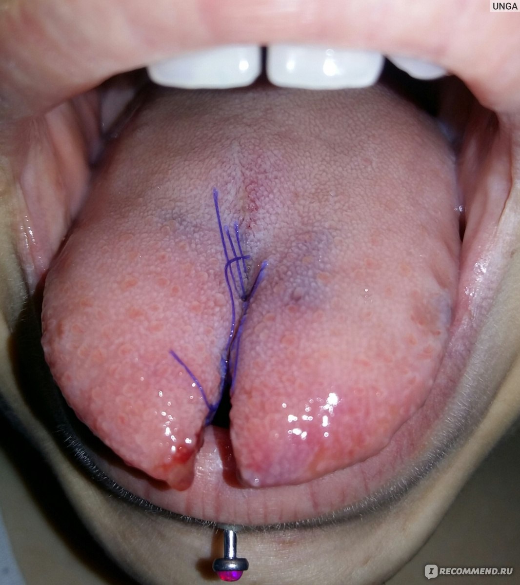 Mikkerstche777 - best photos on arc-arma.fr