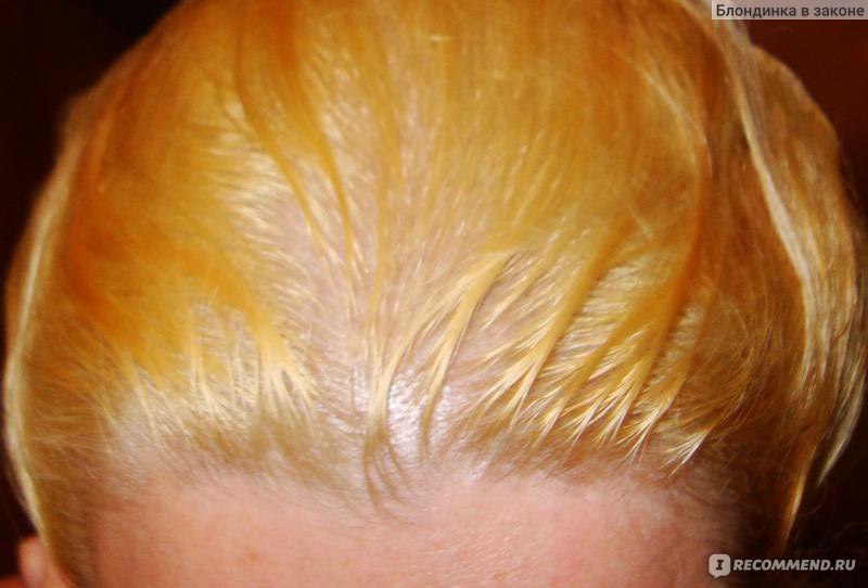 Выпали волосы после осветления. Жёлтые волосы после осветления. Желтые волосы после окрашивания. Осветленные волосы желтые. Желтый цвет волос после осветления.