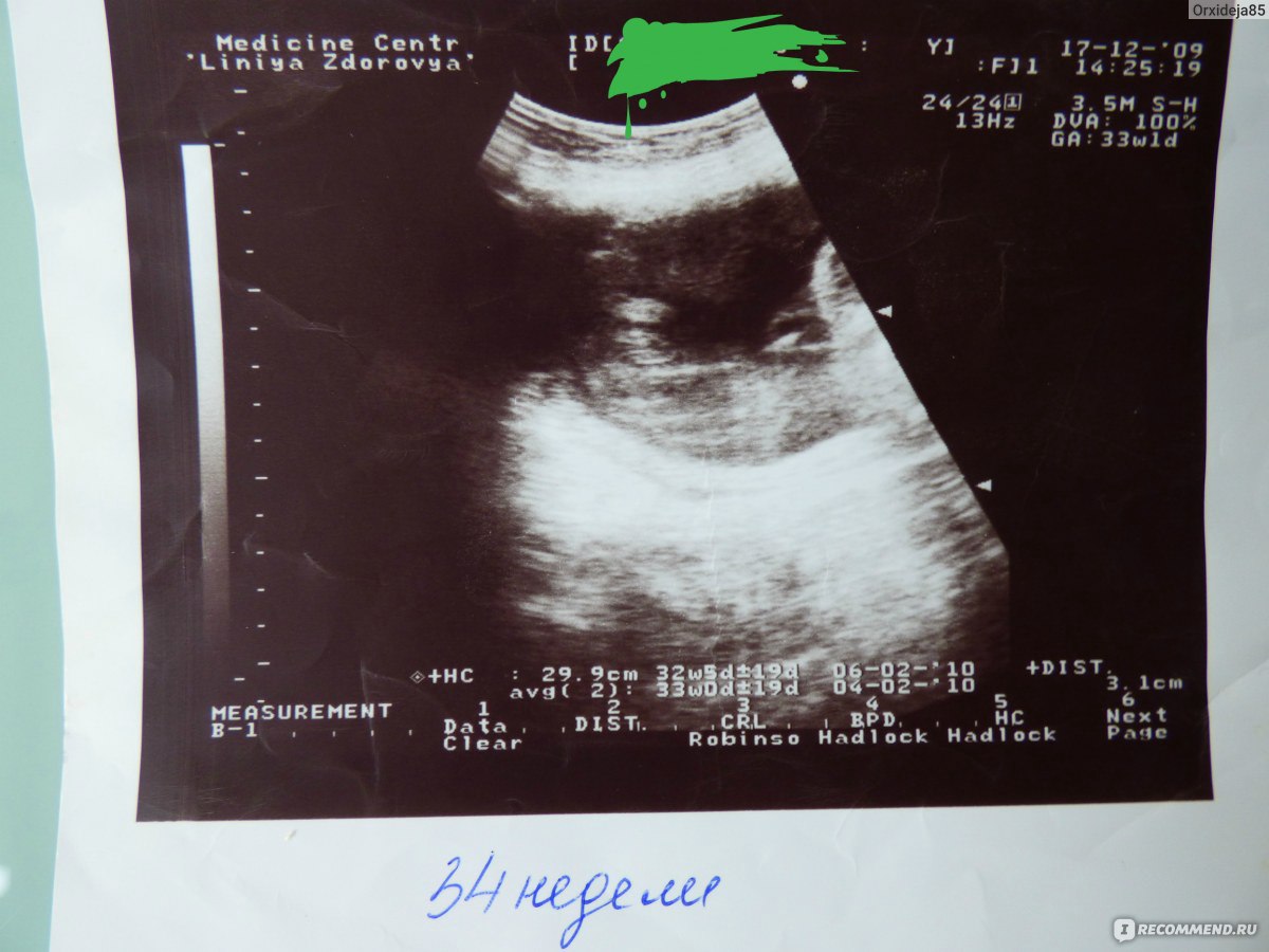 2 неделя беременности от зачатия