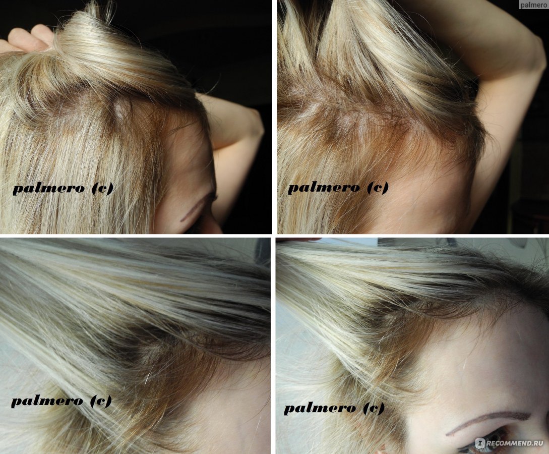 Výhody ricinového oleje pro vlasy:
