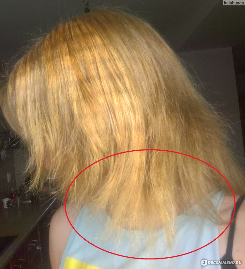 Отпали волосы после обесцвечивания фото
