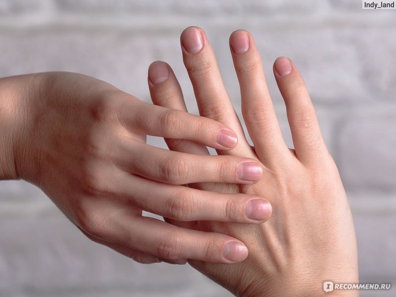 Что говорят ногти о здоровье человека: 12 тревожных признаков