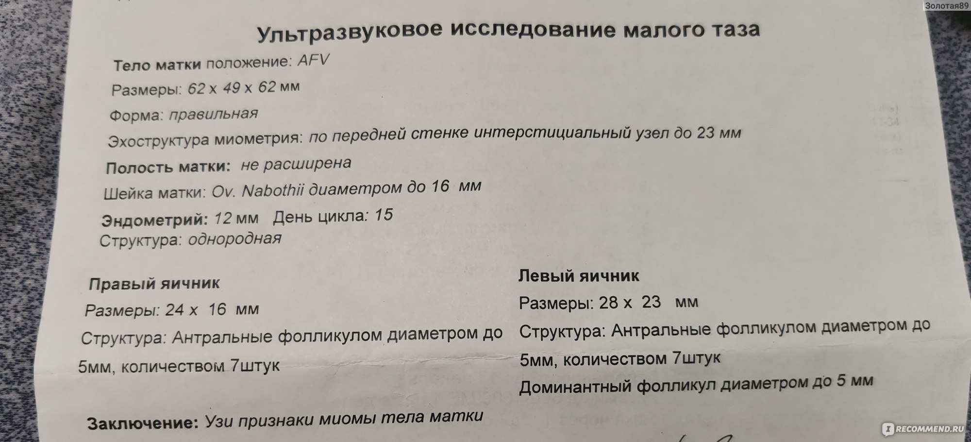 УЗИ трансвагинальным датчиком - «Аборт в ходу ➩Выжидательная тактика при  замершей беременности. УЗИ органов малого таза 10 раз за пару месяцев.  Гинекологическое УЗИ в начале цикла и в середине. А всё ли