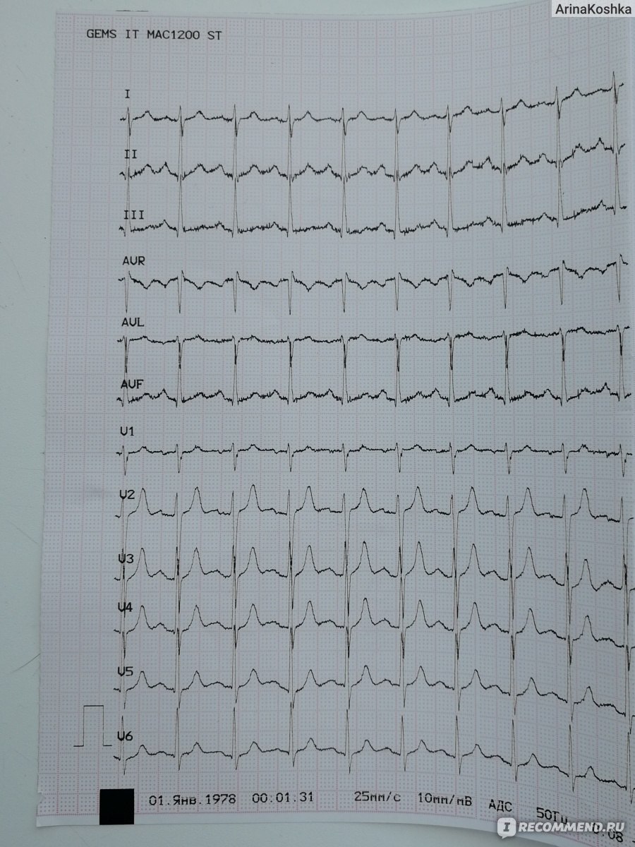электронная регистратура москва. записаться на мрт. платное узи сердца. гинекологические операции по полису омс. операции на глазах по полису омс.