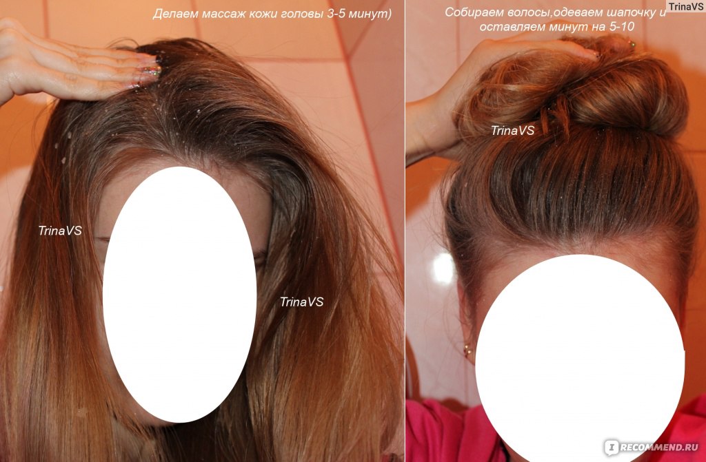 Как ускорить рост волос и увеличить густоту волос