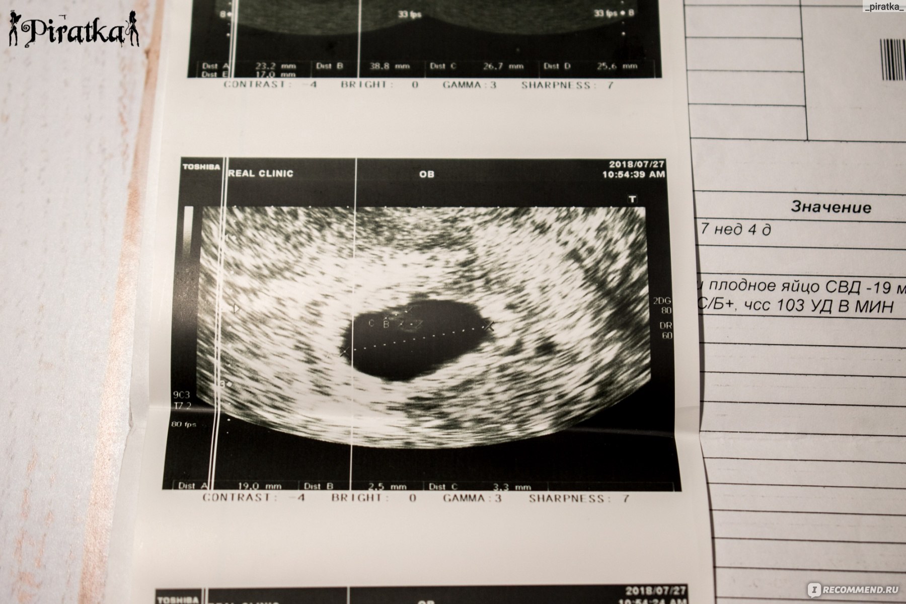 у меня перестала болеть грудь беременность 5 6 недель фото 58
