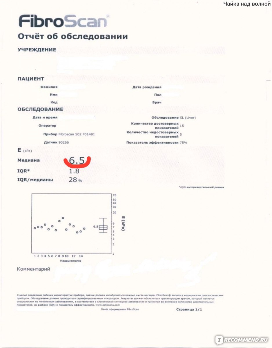 Фибросканирование (эластография) печени - «Инновационный, безболезненный  метод обследования, который покажет состояние печени. Может диагностировать  фиброз, цирроз и рак печени. » | отзывы