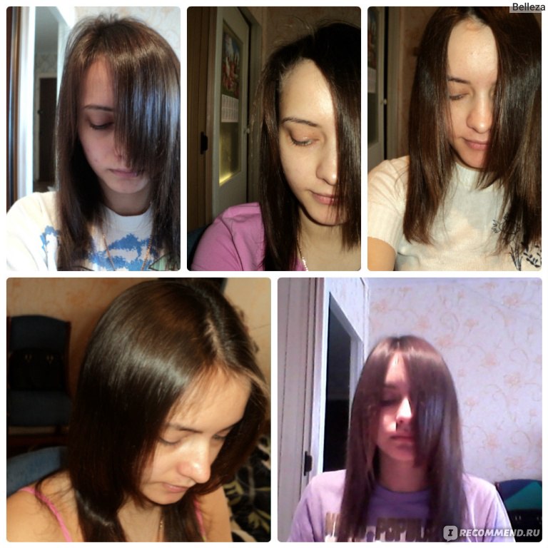 Как отрастают волосы с нуля по месяцам с фото