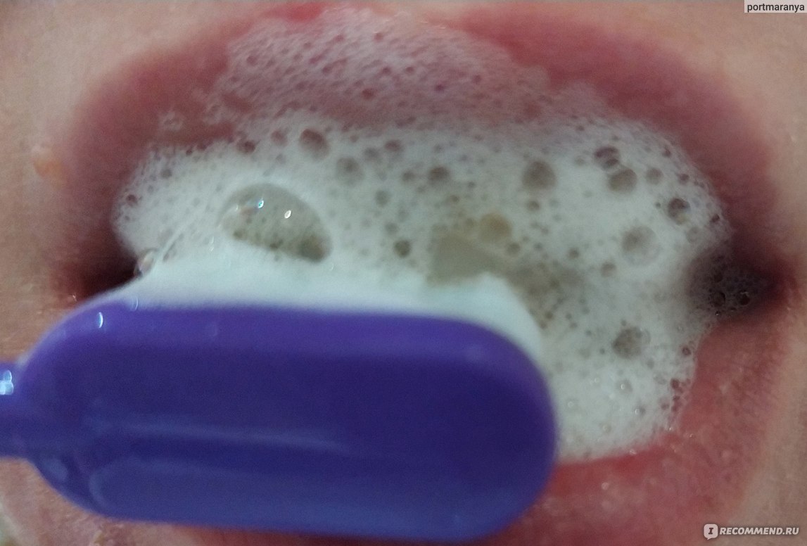 Зубная паста 5 STAR COSMETIC Травяная отбеливающая с экстрактом ананаса фото