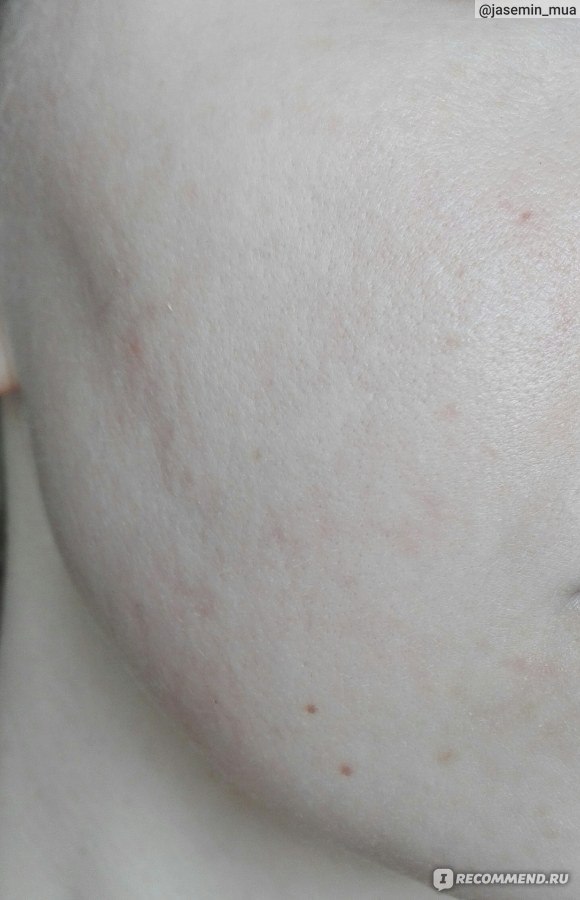 Крем для лица Альпика Липосомальный БиоРитм фото
