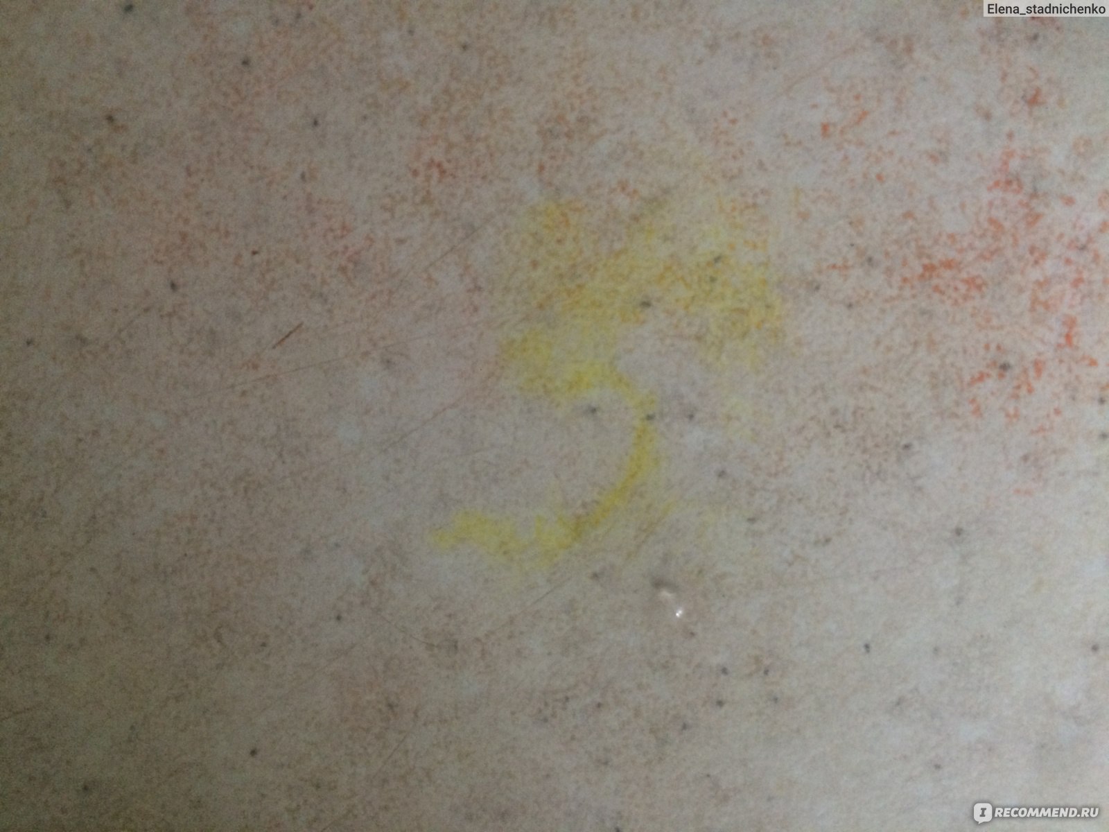 Вижу желтое пятно. Желтое пятно. Пятна на столешнице. На ноге образовалось желтое пятно. На линолиуме жёлтое пятно.