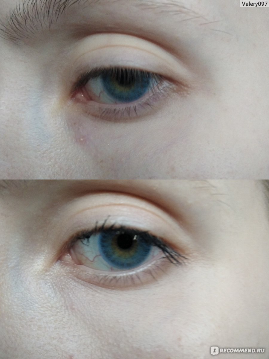 Глаз до и после нанесения консилера