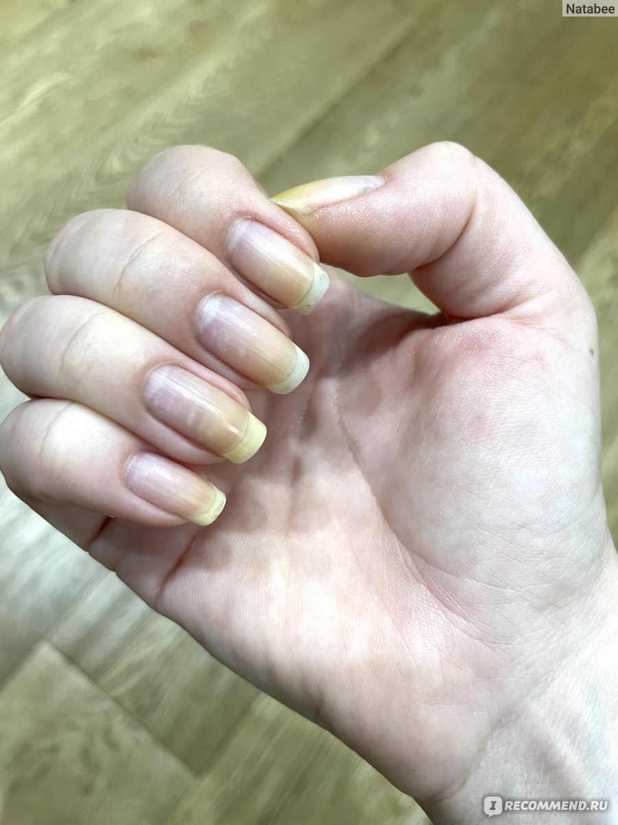 Средство для удаления кутикулы Kinetics Cuticle off - «Маникюр дома 💅 мой  помощник в удалении кутикулы» | отзывы