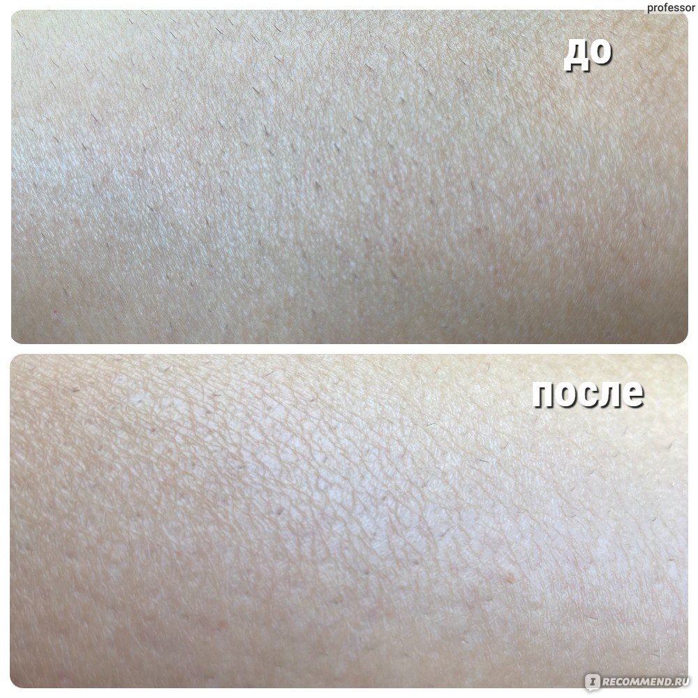 Фотоэпилятор SmoothSkin Bare PLUS IPL Hair Removal - «Домашний фотоэпилятор  - это эффективное удаление волос в домашних условиях, и значительная  экономия времени и денег.» | отзывы