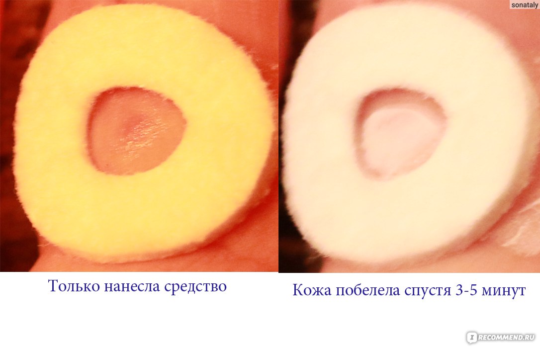 VERRUXIN на коже