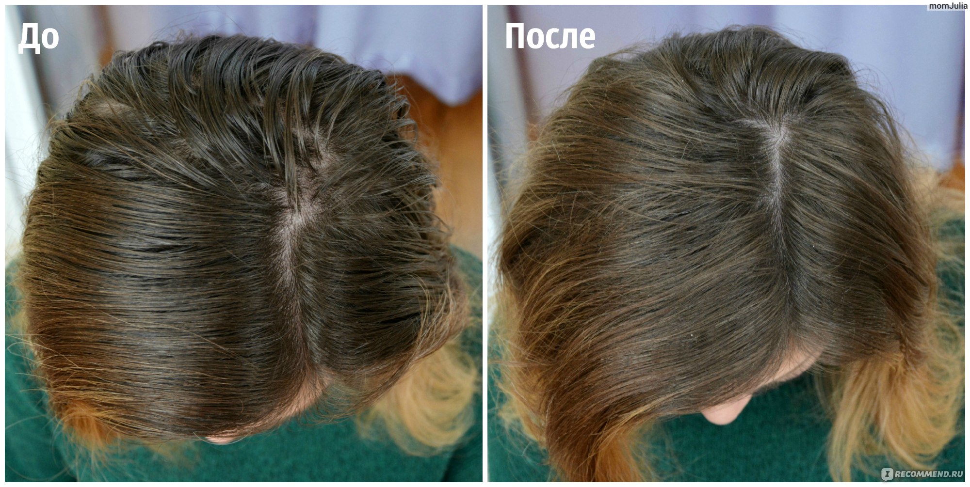 Волосы после сухого шампуня. Сухой шампунь до и после. Сухой шампунь для волос эффект до и после. Шампунь для сухих волос.