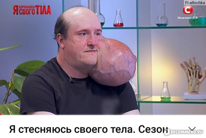 Я стесняюсь своего тела