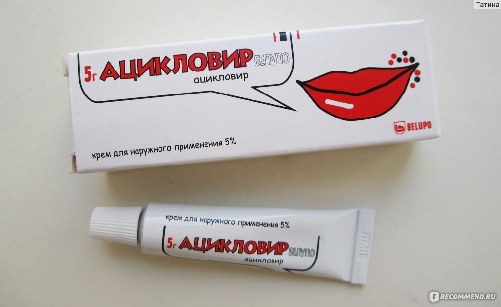 Мазь для наружного применения Belupo Ацикловир - «Как быстро избавиться от  герпеса на губах? Ацикловир белупо - супергерой на страже красивых улыбок.  Как бонус гламурная упаковка!» | отзывы