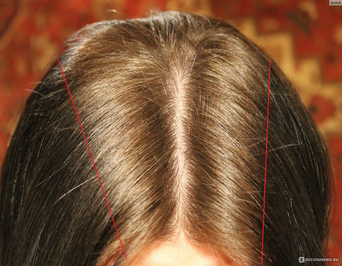 Как быстро растут волосы от пантовигара