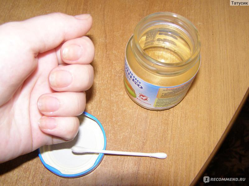 Как лечить ногти уксусом