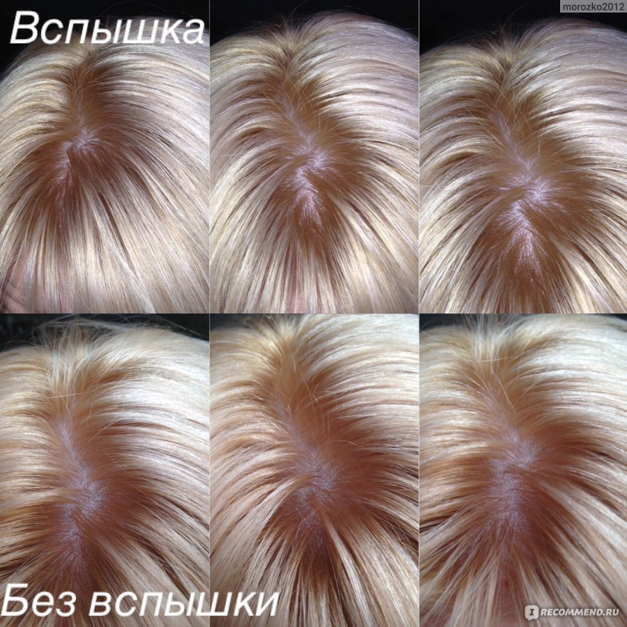 Эстель сос 116 фото на волосах