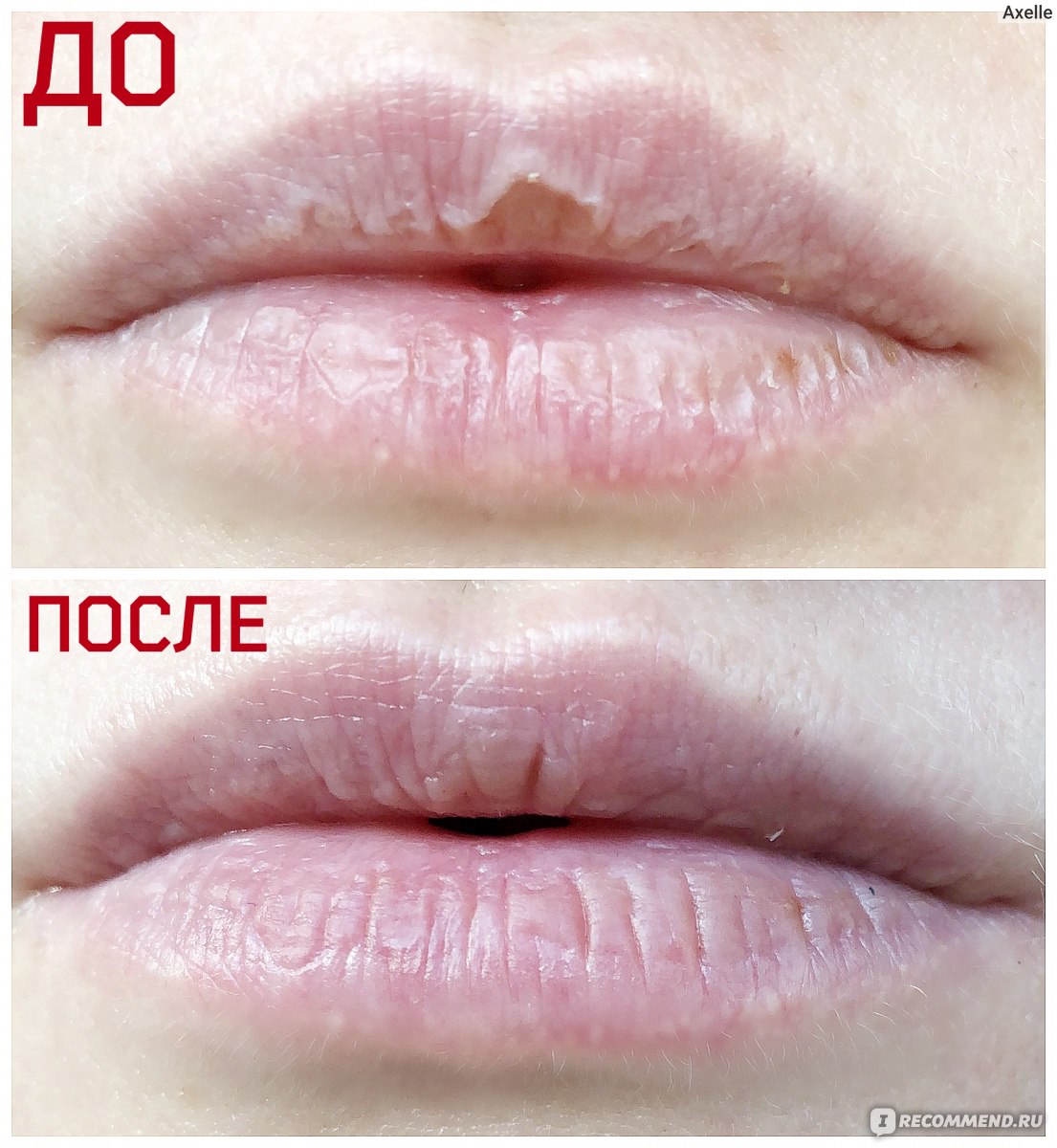 Коллаген губы до и после отзывы Патч для губ Bioaqua Pink Collagen Lip Mask Care Gel Membrane Moisture Anti-Agei