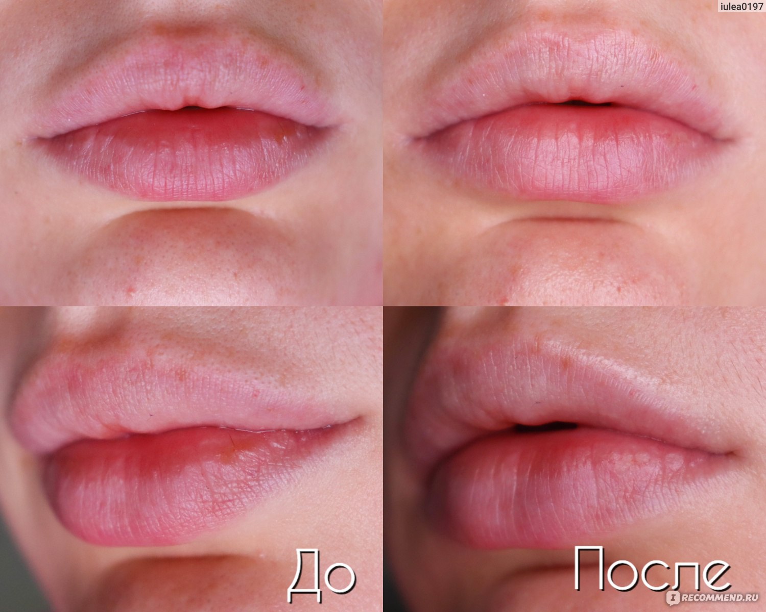 Маска для губ XYBEIBI Collagen nourish lips membrane  фото