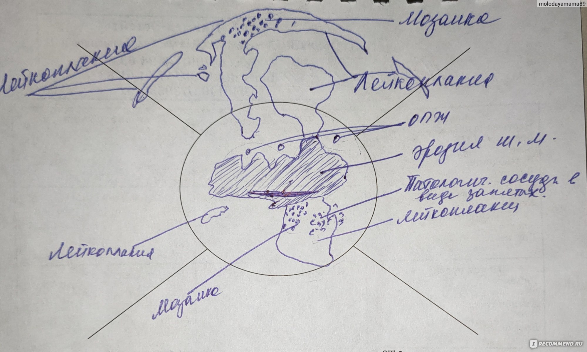 Цервикон дим свечи фото