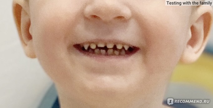Исходные зубки после операции;