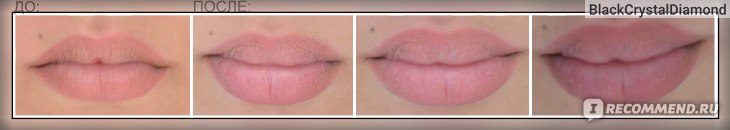 Плампер для губ Fullips Lip Enhancers Увеличитель губ фото