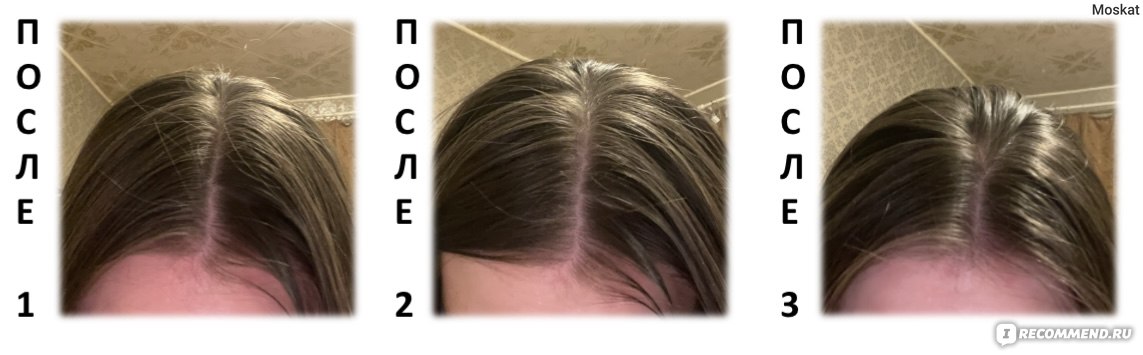 Сухой шампунь Frelia для всех типов волос,150 мл фото