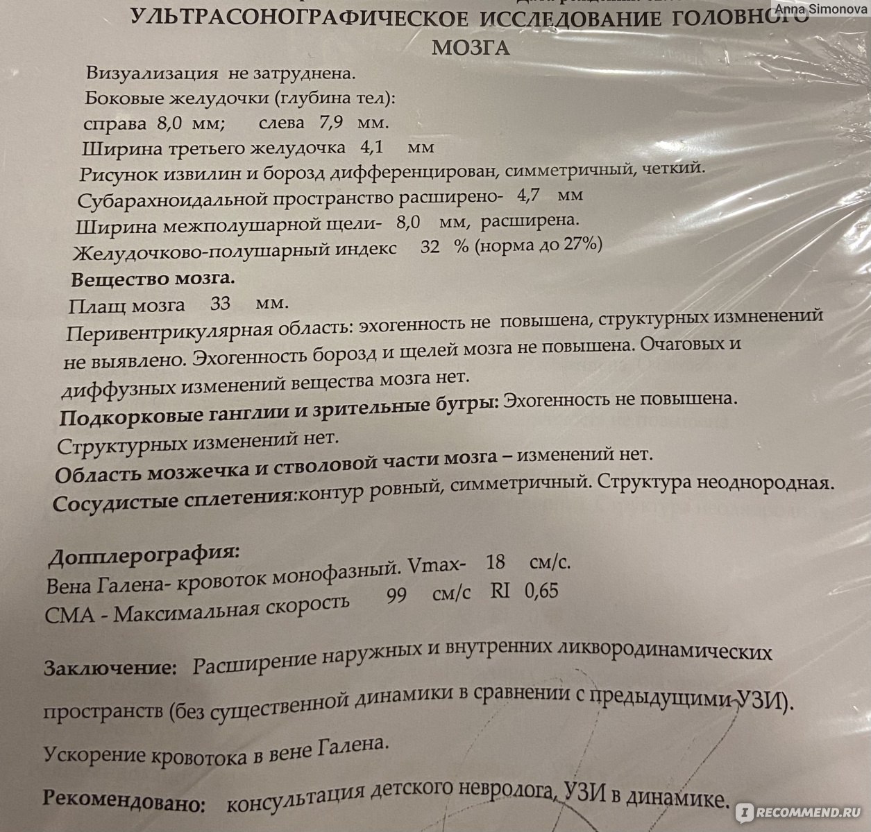 Нейросонография УЗИ головного мозга - «Неотъемлемое исследование перед  посещением невролога до года для нас » | отзывы