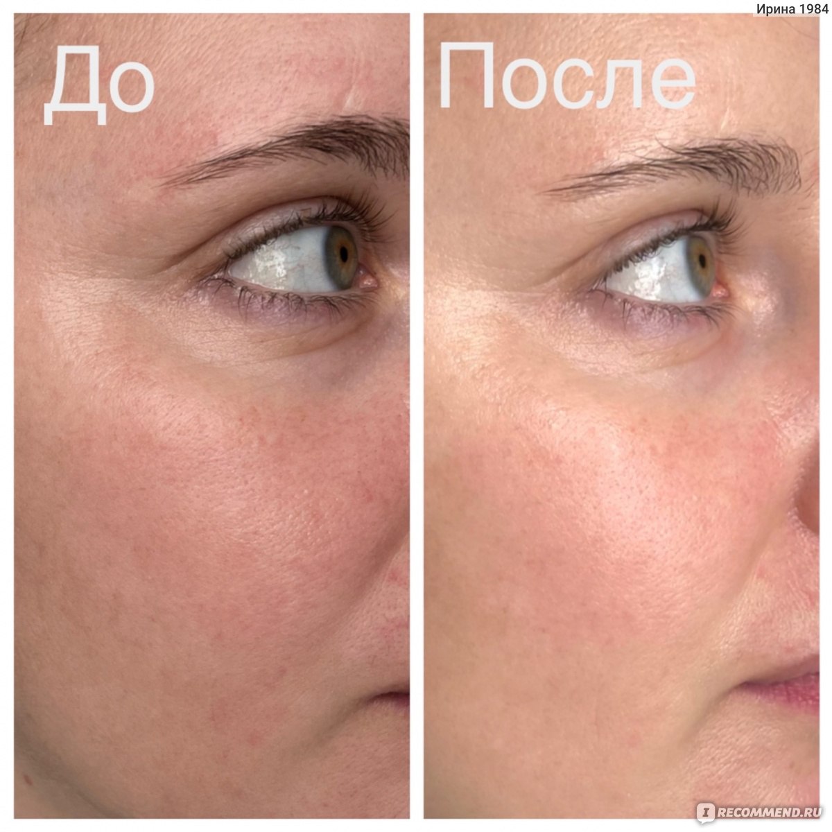 Тканевая маска для лица Rorec Olive Natural Skin Care Mask фото