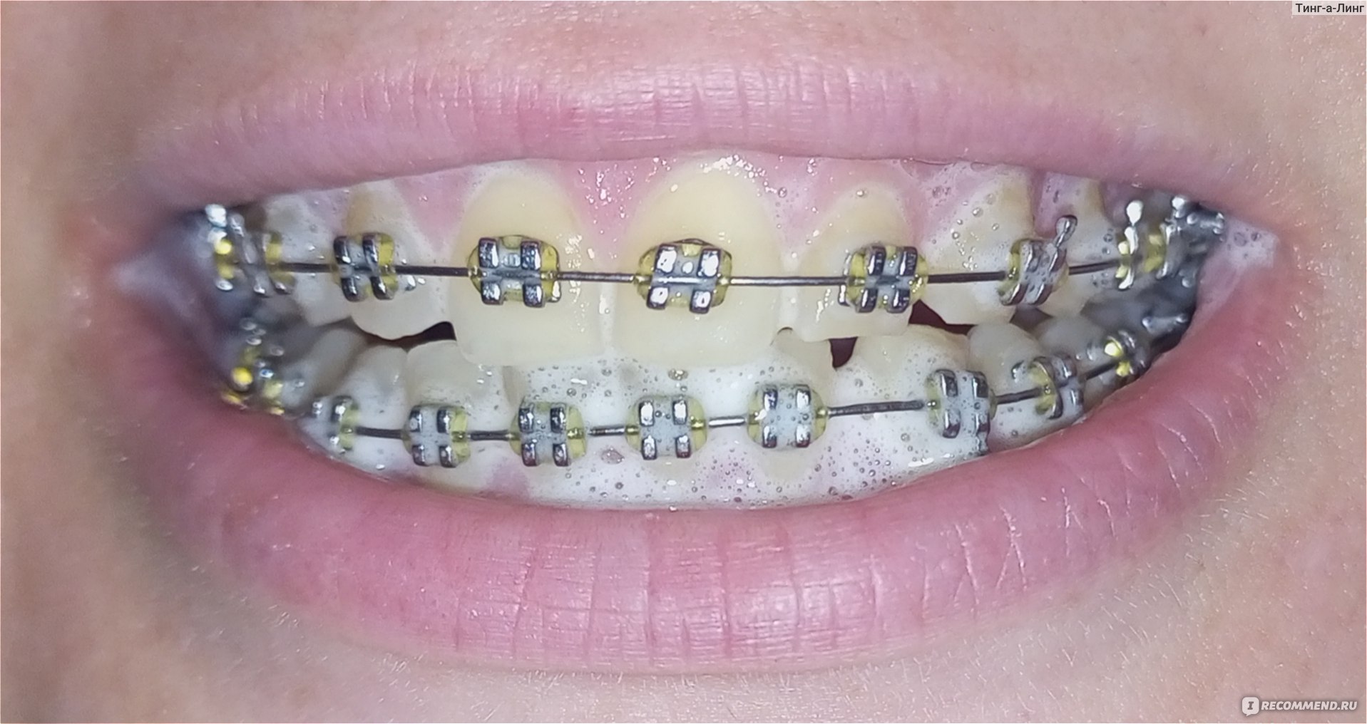 Зубная паста R.O.C.S.Teeth Whitening фото