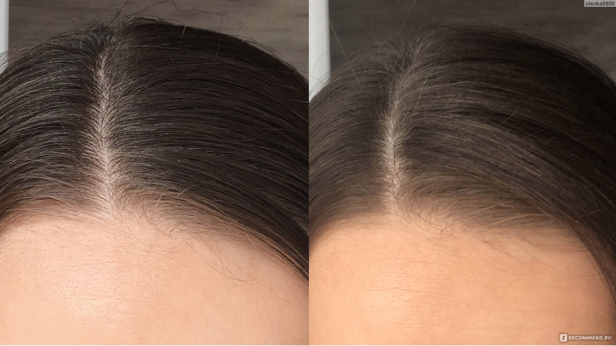 Волосы после сухого шампуня. Сухой шампунь для волос до и после. Жирные волосы до после. Сухой шампунь фото до и после.