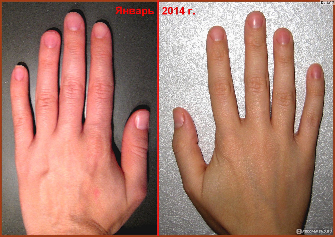 Изменение формы руки. Изменение формы ногтей. Изменение формы ногтей на руках. Ногти до и после изменения формы. Удлинить ногтевое ложе.