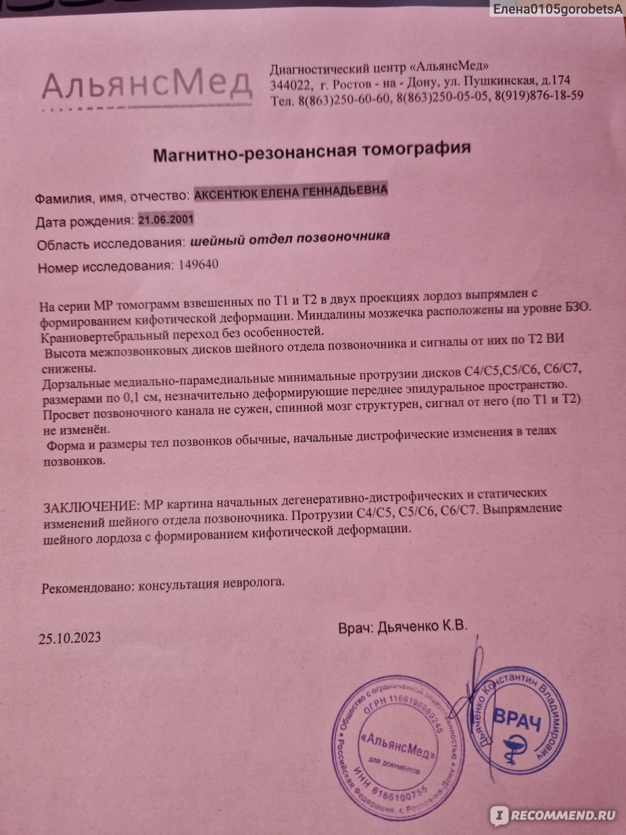 Таблетки Gedeon Richter Мидокалм Лонг - «Ужасно болела шея напротяжении 5  лет. А после МРТ оказывается- забитые мышцы. Миофасциальный синдром и что  будет, если пить мидокалм Лонг 10 дней. Я не выдержала